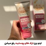 کرم تخصصی درمان ترک پوستی