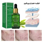 سرم قوی برطرف کننده جوش ( نمونه اصلی) - Image 2