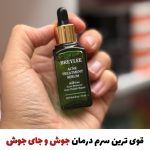 سرم قوی برطرف کننده جوش ( نمونه اصلی)