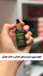 سرم قوی برطرف کننده جوش ( نمونه اصلی)